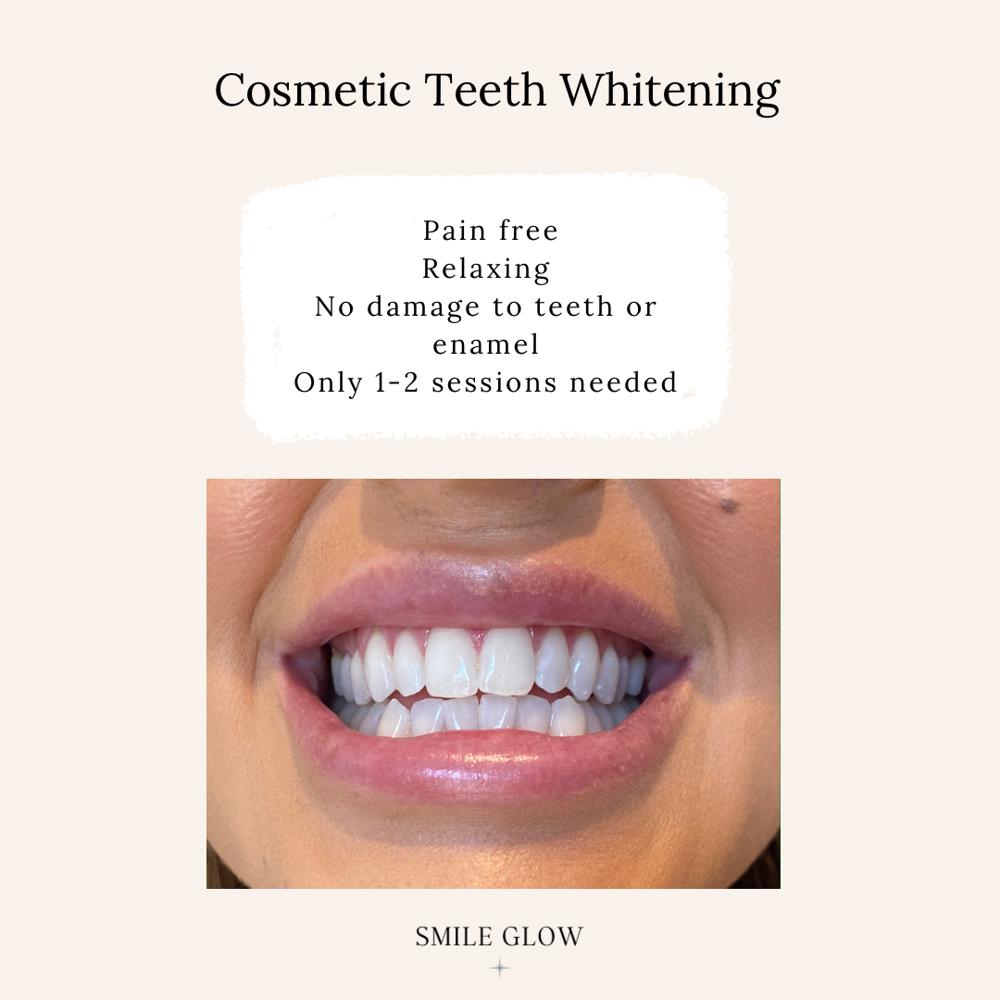 Smile Glow Teeth Whitening - Result Image